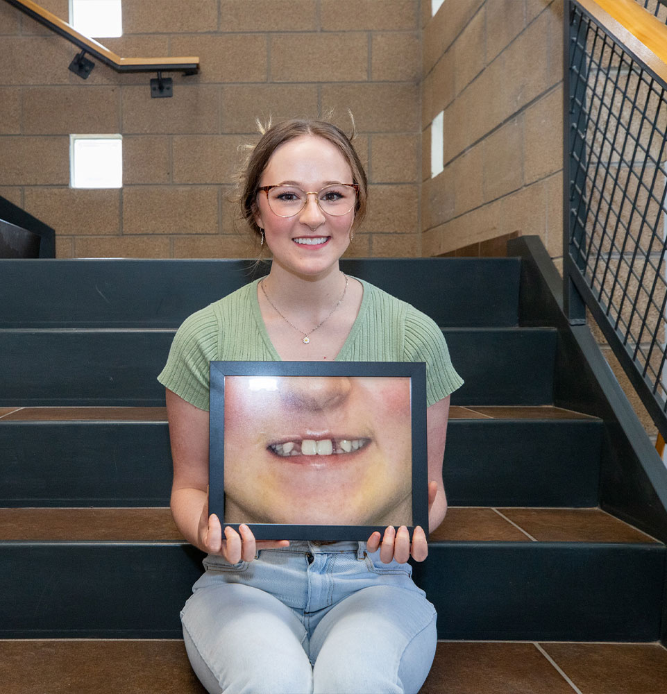 Patient Showing a picture of their teeth before there dental procedure